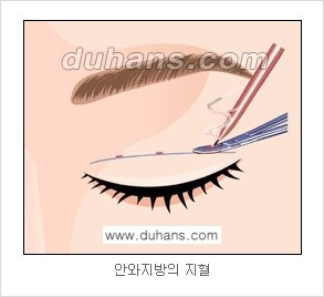 ​[두한성형외과 경쟁력 눈성형] - [자연스러운면서 매력적인 쌍꺼풀 퀵 쌍꺼풀 수술 안내] 관련 이미지 11
