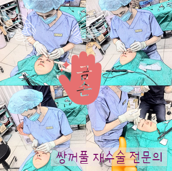 [두한성형외과 눈재수술] - [지방이식과 쌍꺼풀재수술 동시에 하는 경우] 관련 이미지 39
