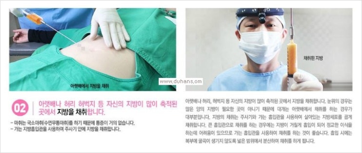 [두한성형외과 경쟁력 눈밑 다크써클 치료] - [눈밑 다크써클과 눈위 지방이식 콤비 프로그램 안내] 관련 이미지 6