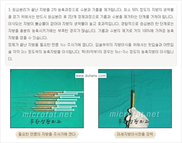 [두한성형외과의 경쟁력 미세지방이식] - [무턱교정 - 턱 미세지방이식 안내 1.] 관련 이미지 11