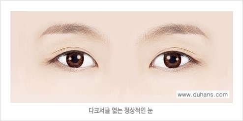 [두한성형외과 경쟁력 다크써클 치료] - [다크써클 5단계로 이뤄지는 핵심 5 STEP SOLUTION 안내 1.] 관련 이미지 3