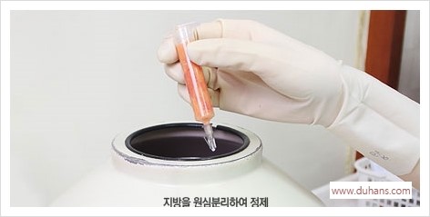 [두한성형외과 경쟁력 눈밑성형] - [눈밑 미세지방이식의 이해도 안내] 관련 이미지 6