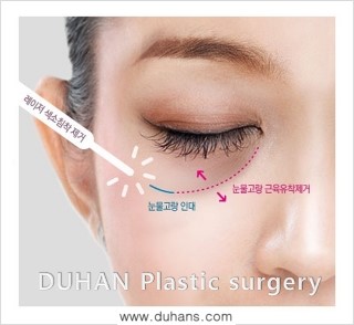 ​☞ [두한성형외과] - [다크써클 클리닉의 핵심 솔루션  5 STEP 을 소개합니다.]☜ 관련 이미지 7