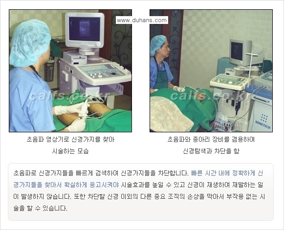 [두한성형외과 경쟁력 종아리성형] - [초음파 유도 선택적 신경차단술 안내 ②] 관련 이미지 9