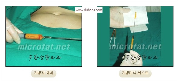 [두한성형외과 경쟁력 지방이식] - [두한 자가지방이식 클리닉 안내]​ 관련 이미지 33