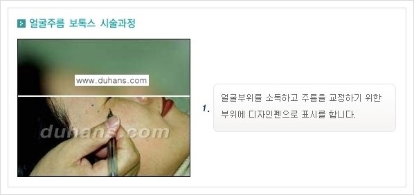 [두한성형외과 경쟁력 주름교정] - [간단 주사요법 - 보톡스 시술 안내 ①] 관련 이미지 5