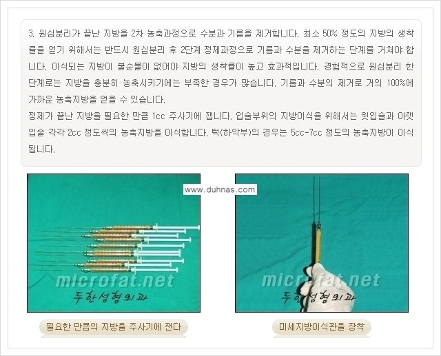 [두한성형외과 경쟁력 미세지방이식] - [입술 미세지방이식 안내 1.] 관련 이미지 6
