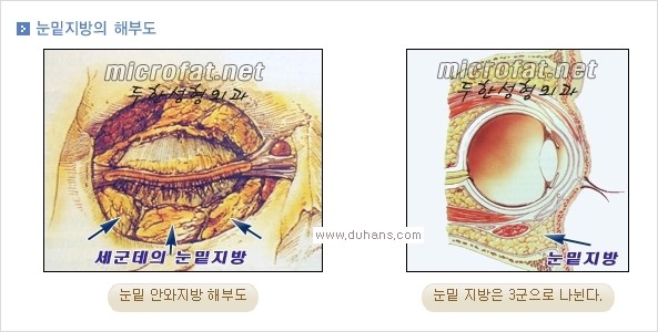 ⁠⁠[두한성형외과 경쟁력 안검성형] - [젊은 눈매를 위한 윗눈꺼풀 지방제거, 눈밑 지방제거] 관련 이미지 12
