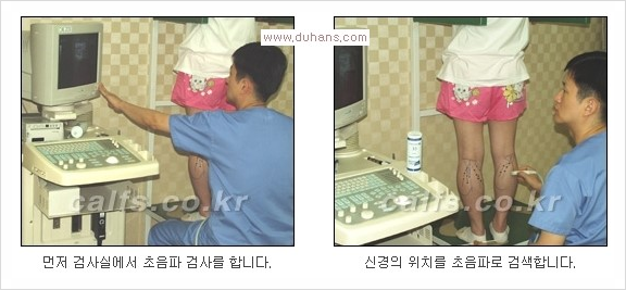 ⁠⁠[두한성형외과 경쟁력 종아리성형] - [굵은 다리의 모양과 원인에 따른 종아리성형 방법] 관련 이미지 2