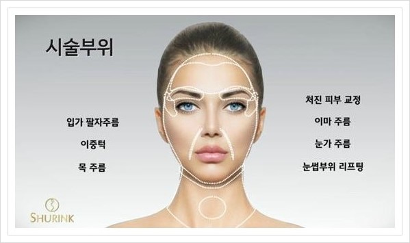 [두한성형외과 경쟁력 주름성형] - [HIFU 초음파 리프팅 주름교정술 안내 2.] 관련 이미지 6