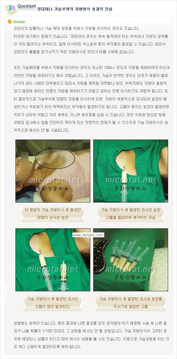 [두한성형외과 "미세지방이식"] - [미세지방이식에 관한  잘못된 지식 1.] 관련 이미지 5