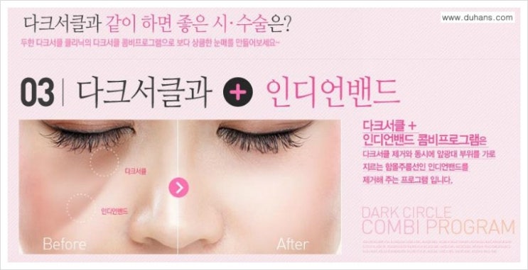 [두한성형외과 무한 경쟁력 다크써클 치료] - [다크써클 + 인디언밴드 콤비 프로그램] 관련 이미지 1