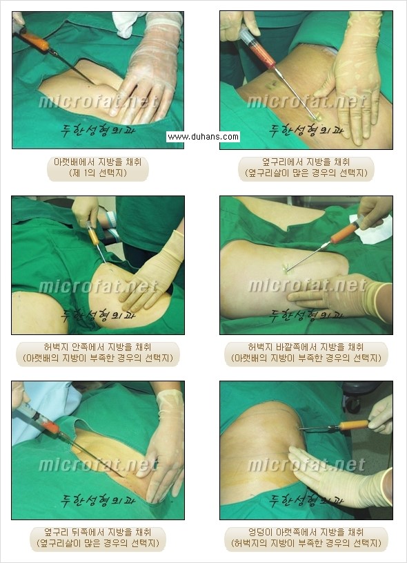 [두한성형외과 경쟁력 미세지방이식] - [Dr. 컬럼 "미세지방이식 클리닉의 특징과 자부심"] 관련 이미지 3
