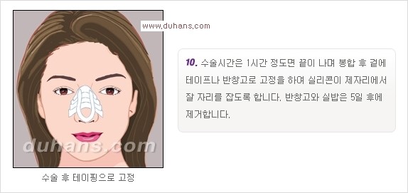[두한성형외과 경쟁력 코성형] - [코성형을 위한 알로덤(슈어덤) 수술, 실리콘 수술 안내] 관련 이미지 27