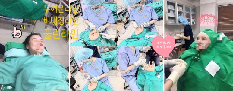 Best Place for Double Eyelid Revision Surgery, Duhan Plastic Surgery - Partial Incision Eye Revision Surgery image 52