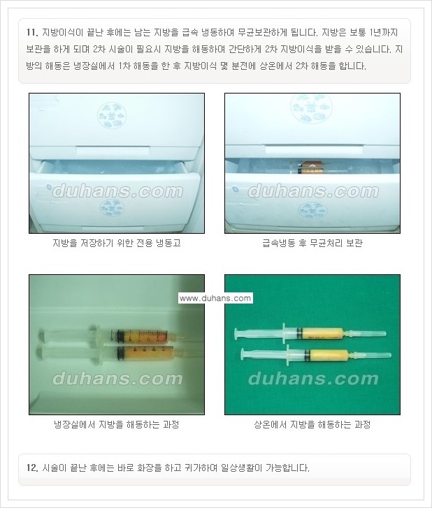 [두한성형외과 경쟁력 미세지방이식] - [부드럽고 아름다운 얼굴선 만들기, 얼굴 미세지방이식 과정 안내] 관련 이미지 10