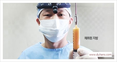 [두한성형외과 경쟁력 눈밑성형] - [눈밑 미세지방이식의 이해도 안내] 관련 이미지 5