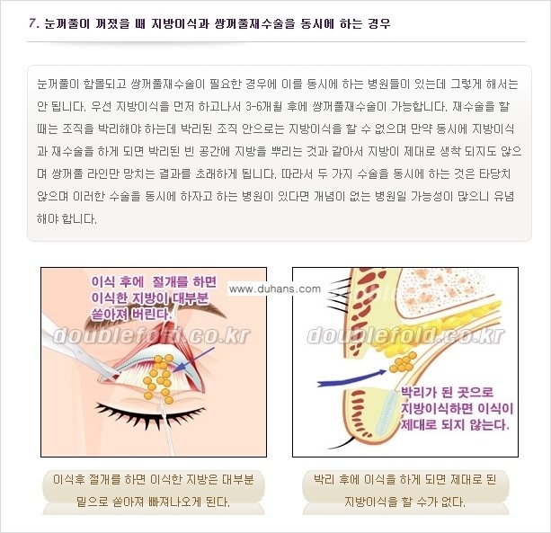 [두한성형외과 경쟁력 쌍꺼풀 재수술(눈재수술)] - [쌍꺼풀 재수술(눈재수술)의 실패의 원인 분석] 관련 이미지 8