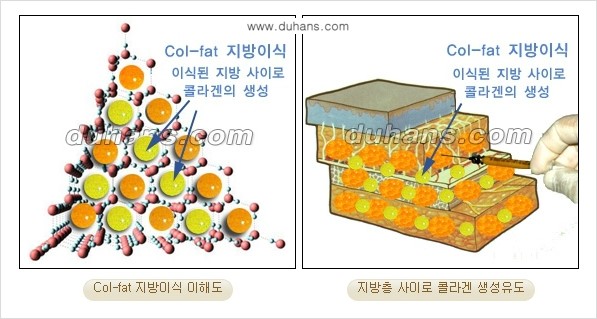 [두한성형외과 경쟁력 미세지방이식] - [탄력있는 피부와 윤곽을 만들어주는 Col-fat 지방이식] 관련 이미지 4