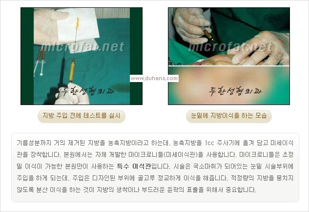 [두한성형외과 경쟁력 눈밑성형] - [눈밑 애교살 시술을 위한 미세지방이식] 관련 이미지 6