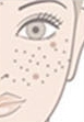 Duhan Plastic Surgery Laser Treatment - Mole Removal, Spot Removal, Melasma, Blemishes, Hyperpigmentation, Skin Tone Improvement, Elasticity Improvement, Skin Texture Improvement image 8
