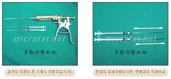 [두한성형외과 자가지방이식] - [3차원 미세지방이식] 관련 이미지 4