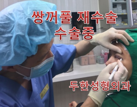 [두한성형외과 쌍꺼풀재수술, 이마슈링크]-[#라인낮추기 #소세지개선 #이마슈링크 #울퉁불퉁한이마개선] 관련 이미지 2