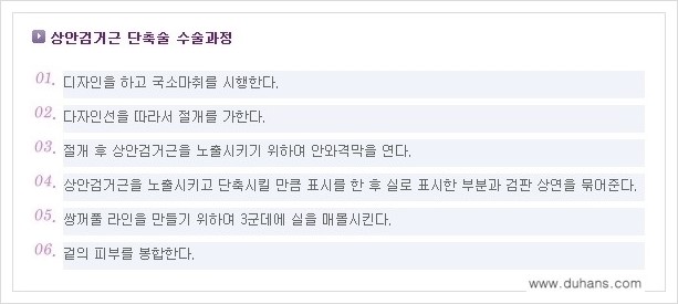 [두한성형외과 경쟁력 쌍꺼풀 재수술(극한 재수술)] - [안검하수(졸리운 눈매) 교정 안내 2.] 관련 이미지 3