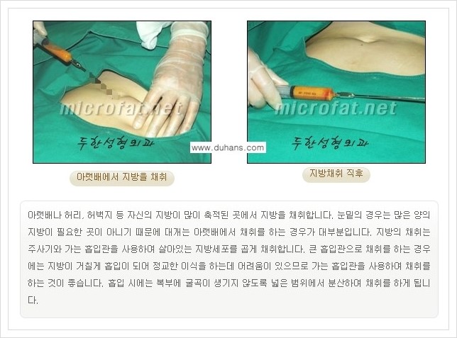 [두한성형외과 경쟁력 눈밑성형] - [눈밑 다크써클, 눈밑 주름의 교정 안내 1.] 관련 이미지 10