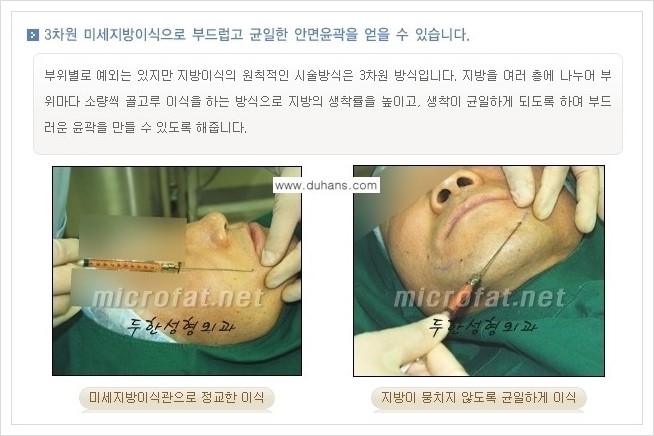 [두한성형외과 경쟁력 미세지방이식] - [두한 미세지방이식 클리닉의 특징 안내] 관련 이미지 12