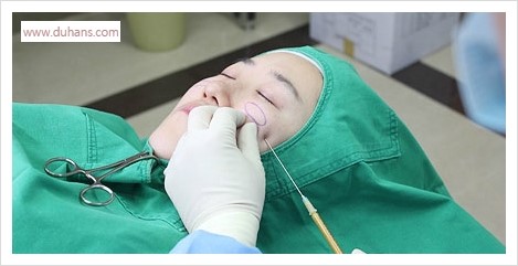 [두한성형외과 경쟁력 멀티성형] - [다크써클 + 인디언밴드 콤비 프로그램 안내] 관련 이미지 8
