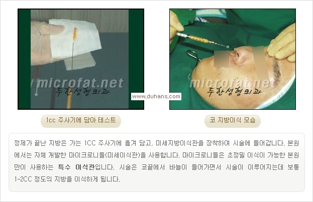 [두한성형외과 경쟁력 주름성형] - [필러주사(쥬비덤)에 대한 올바른 정보 안내] 관련 이미지 6