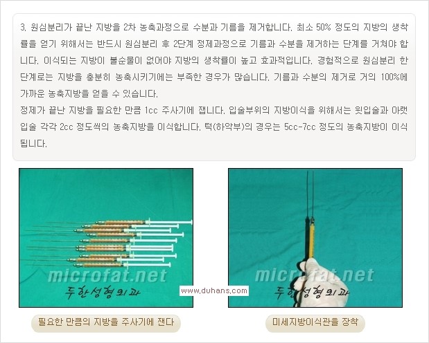 [두한성형외과 경쟁력 미세지방이식] - [입술 3차원 입체지방이식 안내 1.] 관련 이미지 6