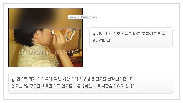 [두한성형외과 경쟁력 레이저시술] - [이산화탄소 점제거 안내] 관련 이미지 7