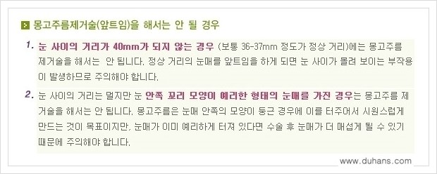 [두한성형외과 경쟁력 눈성형] - [앞트임 수술(몽고주름 제거) 안내 ②] 관련 이미지 10