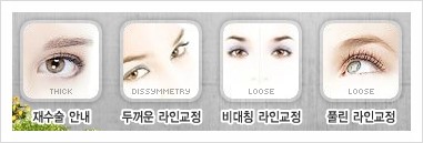 [두한성형외과 경쟁력 쌍꺼풀 재수술 리더] - [비대칭 쌍꺼풀 눈매교정 - 두꺼운 가성 안검하수 + 뒤밑트임] 관련 이미지 2