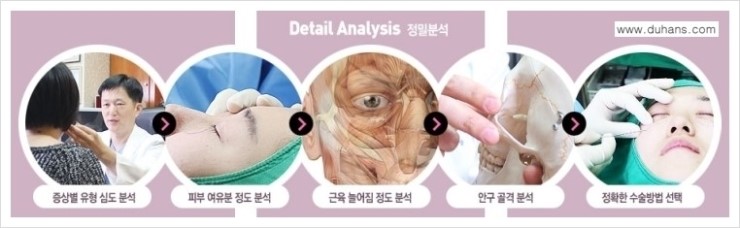 [두한성형외과 경쟁력 다크써클 치료] - [다크써클 5단계로 이뤄지는 핵심 5 STEP SOLUTION 안내 1.] 관련 이미지 11