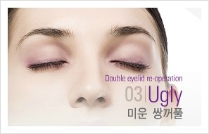 [두한성형외과 경쟁력 쌍꺼풀 재수술] - [비대칭(짝짝이) 쌍꺼풀 라인 교정하는 방법 안내 ①] 관련 이미지 1