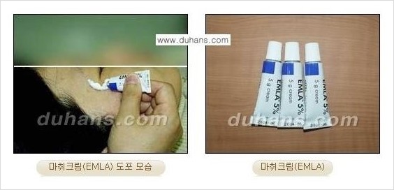 [두한성형외과 안전성형 우선주의] - [성형 통증을 최소화하는 수면마취, 무통마취 안내] 관련 이미지 4
