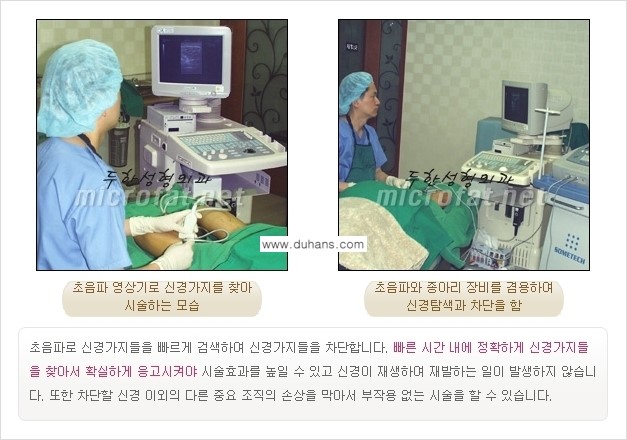 [두한성형외과 경쟁력 멀티종아리성형] - [초음파 유도 비절개 선택적 신경차단술의 효과] 관련 이미지 13