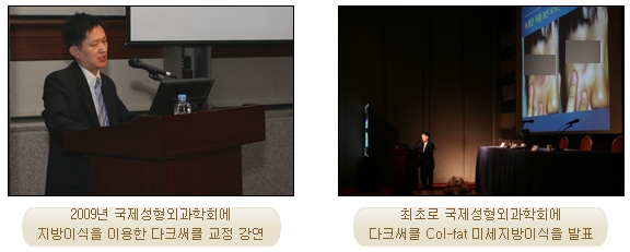Fat Grafting Leader Duhan Plastic Surgery - Everything About Fat Grafting image 2