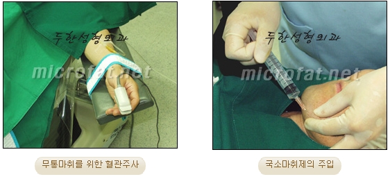 [Duhan Plastic Surgery Liposuction] - [Facial Liposuction] image 7