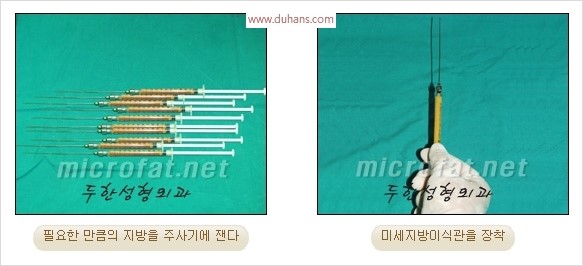 [두한성형외과 경쟁력 안면윤곽 교정] - [자연스럽고 균형있는 턱으로의 복원 미세지방이식과 간편 사각턱 보톡스 안내] 관련 이미지 10
