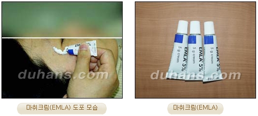 [Duhan Plastic Surgery Double Eyelid Surgery] - [Types of Double Eyelid Surgery] image 45