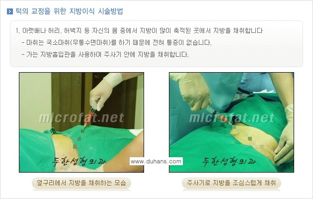 [두한성형외과 경쟁력 미세지방이식] - [얼굴 윤곽 무턱교정 안내 ②] 관련 이미지 2