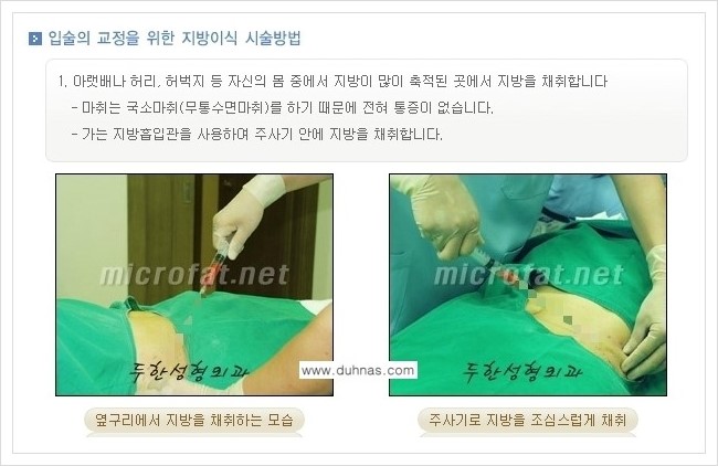 [두한성형외과 경쟁력 미세지방이식] - [입술 미세지방이식 안내 1.] 관련 이미지 4