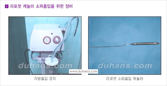 [두한성형외과 경쟁력 액취증 다한증 치료] - [겨드랑이 다한증 치료 방법] 관련 이미지 1
