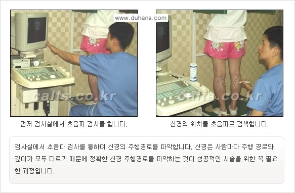 [두한성형외과 경쟁력 멀티종아리성형] - [종아리성형 방법별 전후 주의사항] 관련 이미지 3