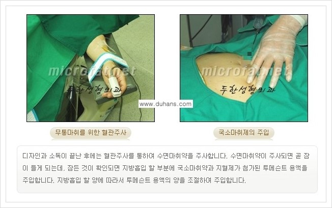 [두한성형외과 경쟁력 맞춤 바디성형] - [간편한 아랫배, 윗배, 허리, 옆구리살, 허벅지, 엉덩이, 복부지방흡입술, 팔뚝(상완부) 지방흡입술 안내] 관련 이미지 5