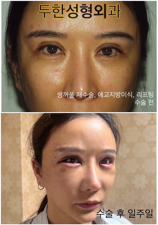 Recommended Duhan Plastic Surgery!! image 1
